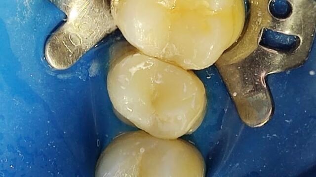 dr.-rafael-cortez-dentista—gramadao-em-sao-miguel-arcanjo-sp